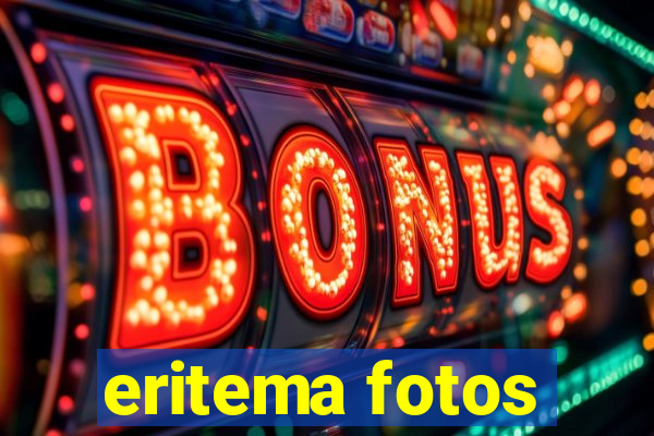 eritema fotos